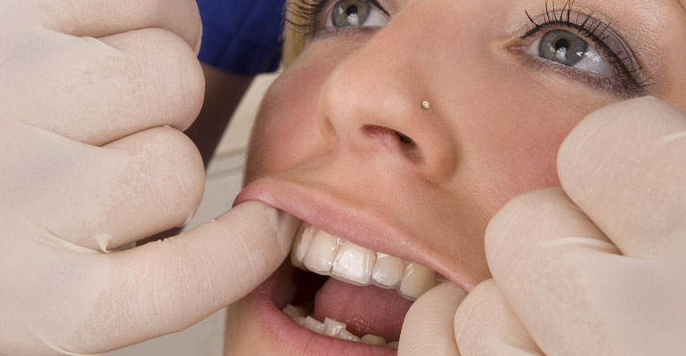 Où trouver un cabinet d’orthodontie invisalign à Paris __Image 1